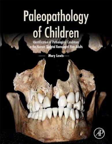 Paleopathology of Children Identification of Pathological Conditions in the Human Skeletal Remains of Non-Adults
